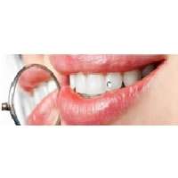 Διακοσμητικά διαμαντάκια