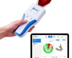 OCCLUSENSE